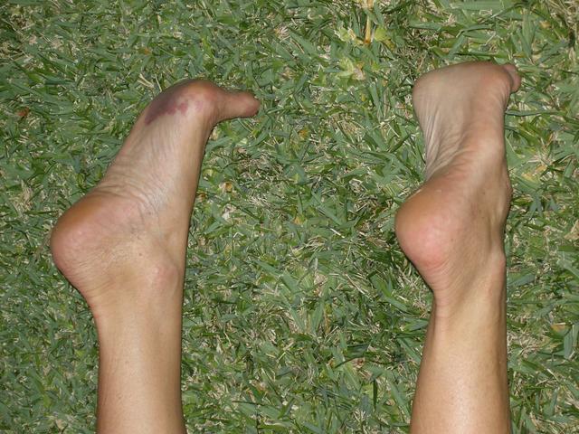 Feet and Grass